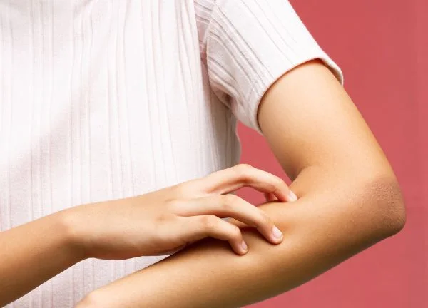 Irritación con persona rascando su brazo